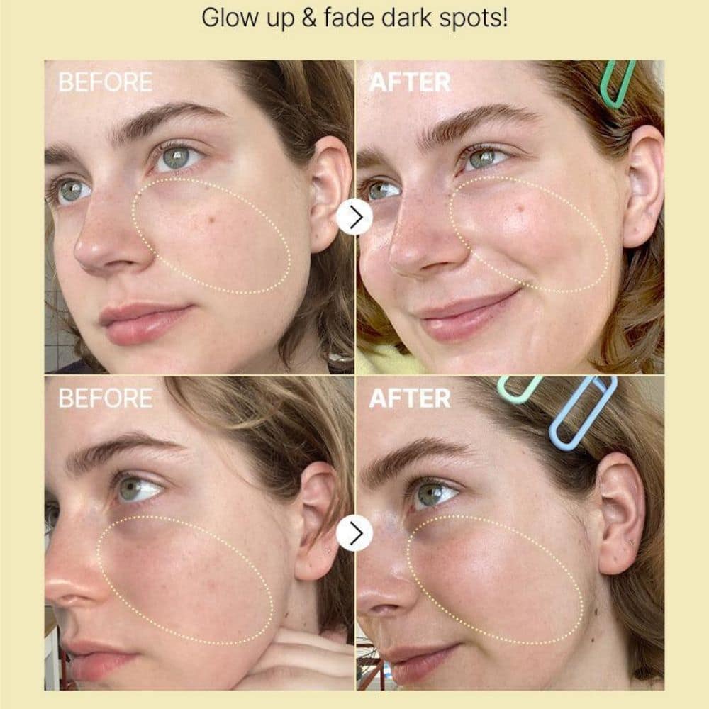 COSRX The Vitamin C 23 Serum (2)