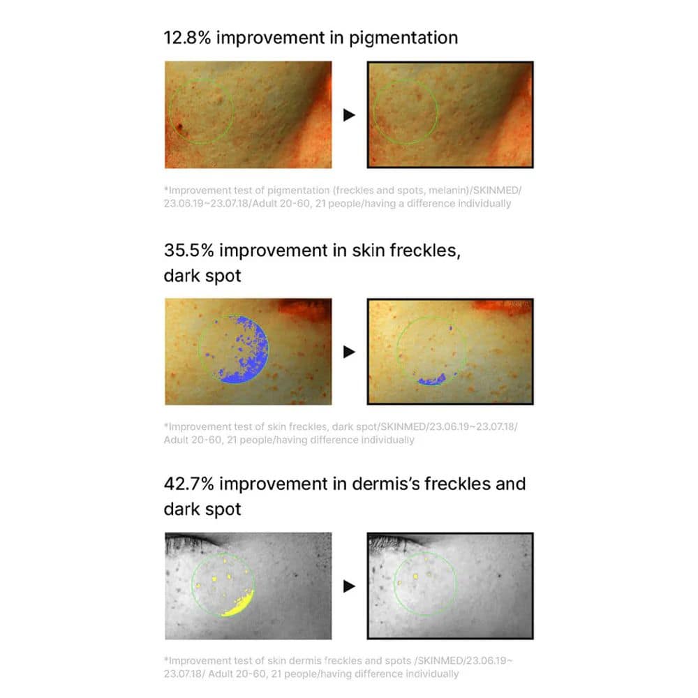 Celimax Pore Dark Spot Brightening Serum