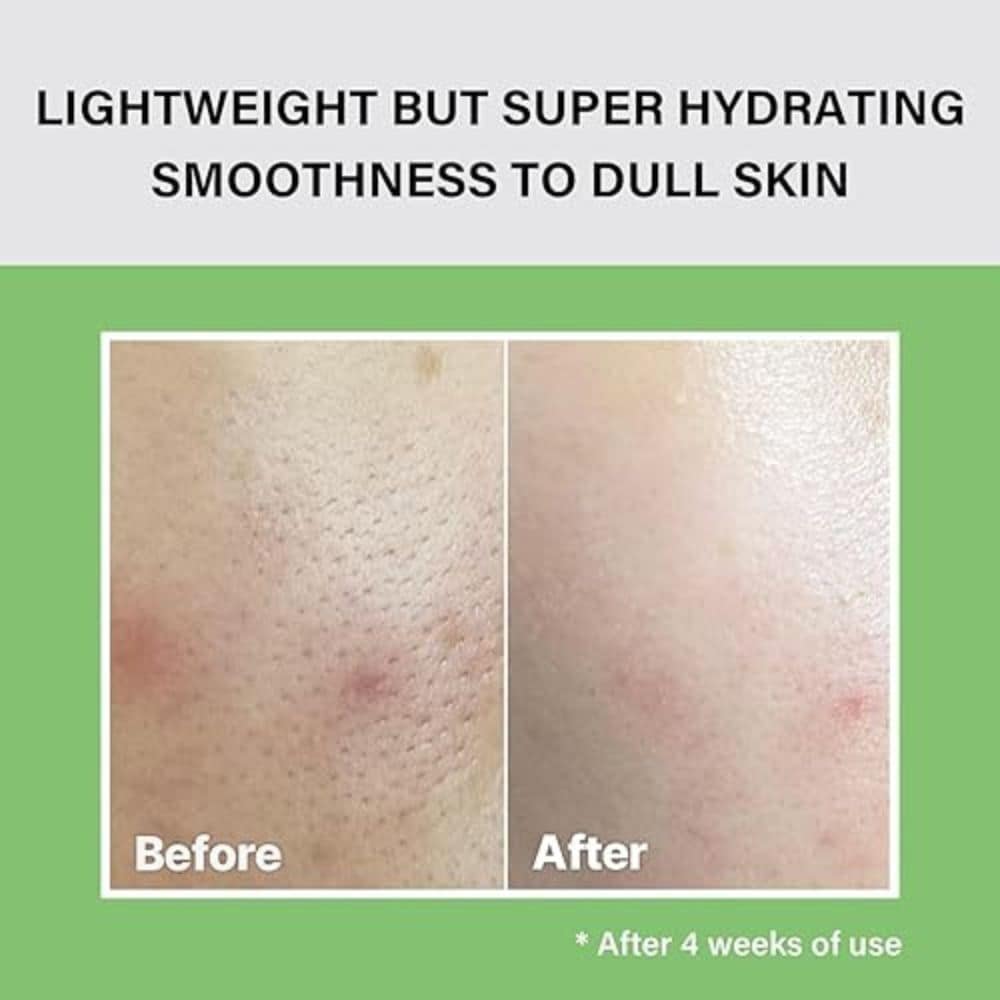 Celimax The Real Noni Moisture Balancing Toner