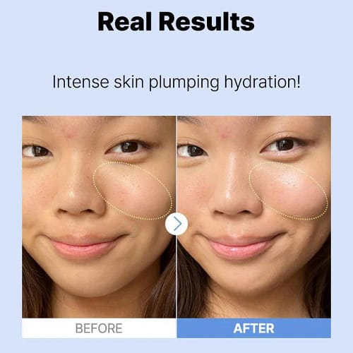 Cosrx The Hyaluronic Acid 3 Serum