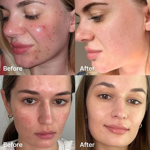 Medicube Red Succinic Acid Serum