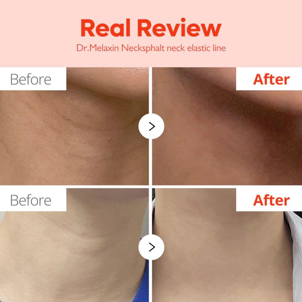 Dr.Melaxin Nexcksphalt Neck ECM Barrier Ampoule