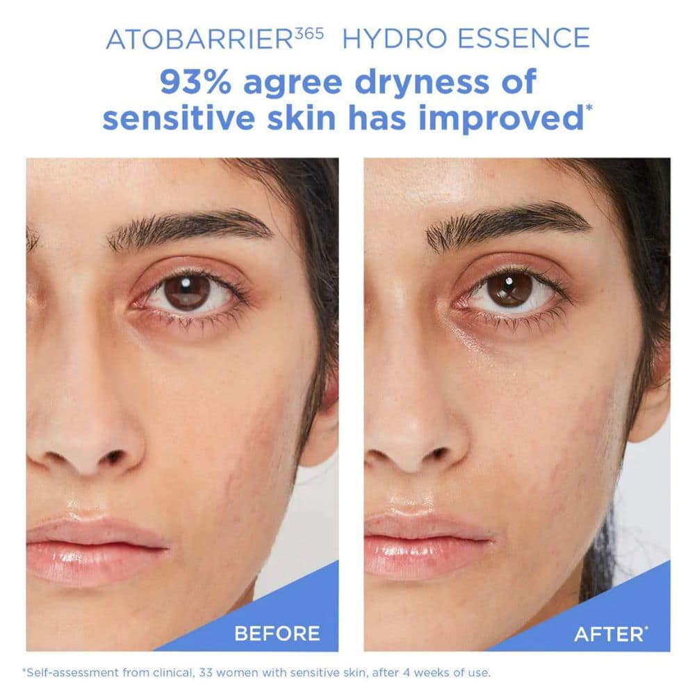 Aestura Atobarrier 365 Hydro Essence
