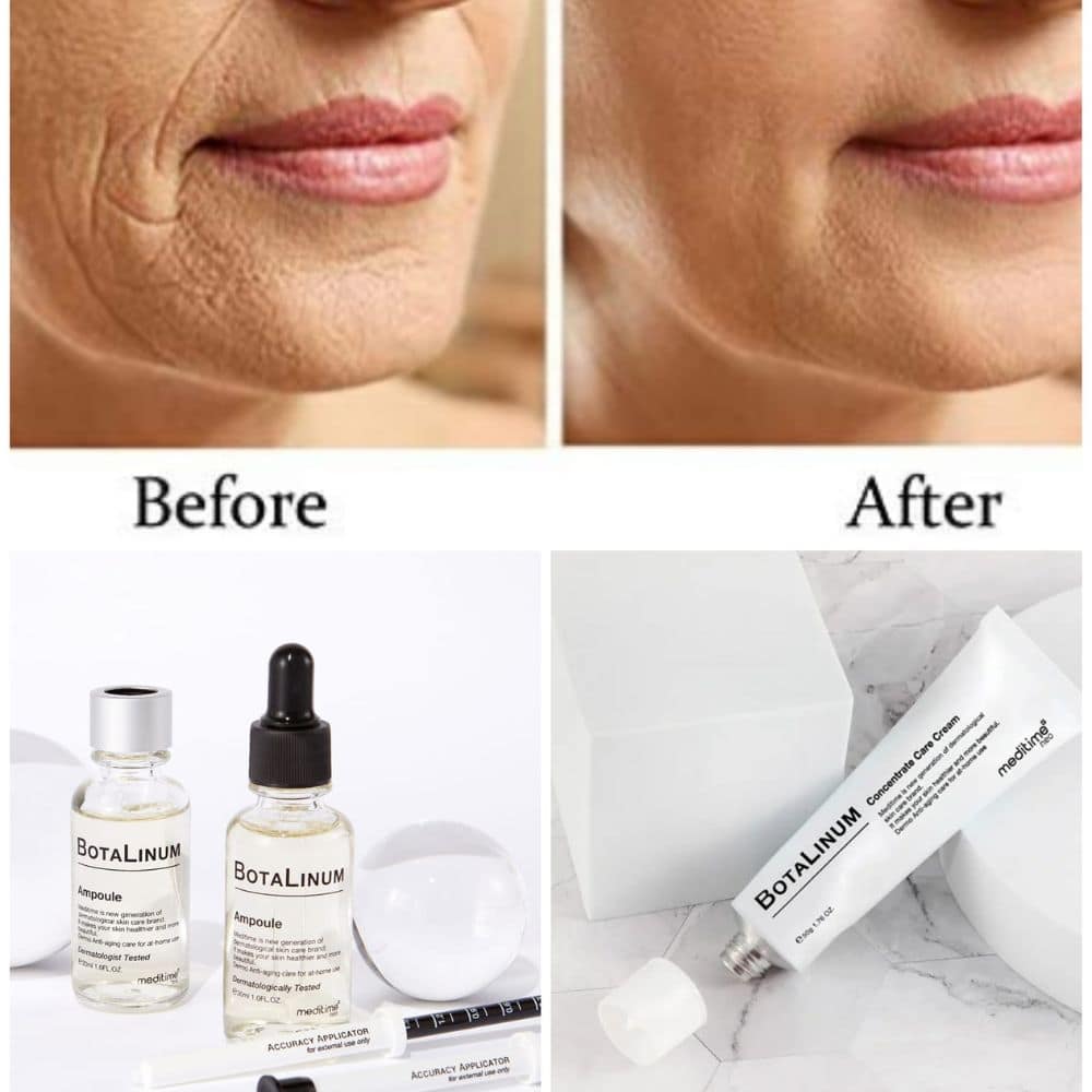 Meditime Botalinum Ampoule