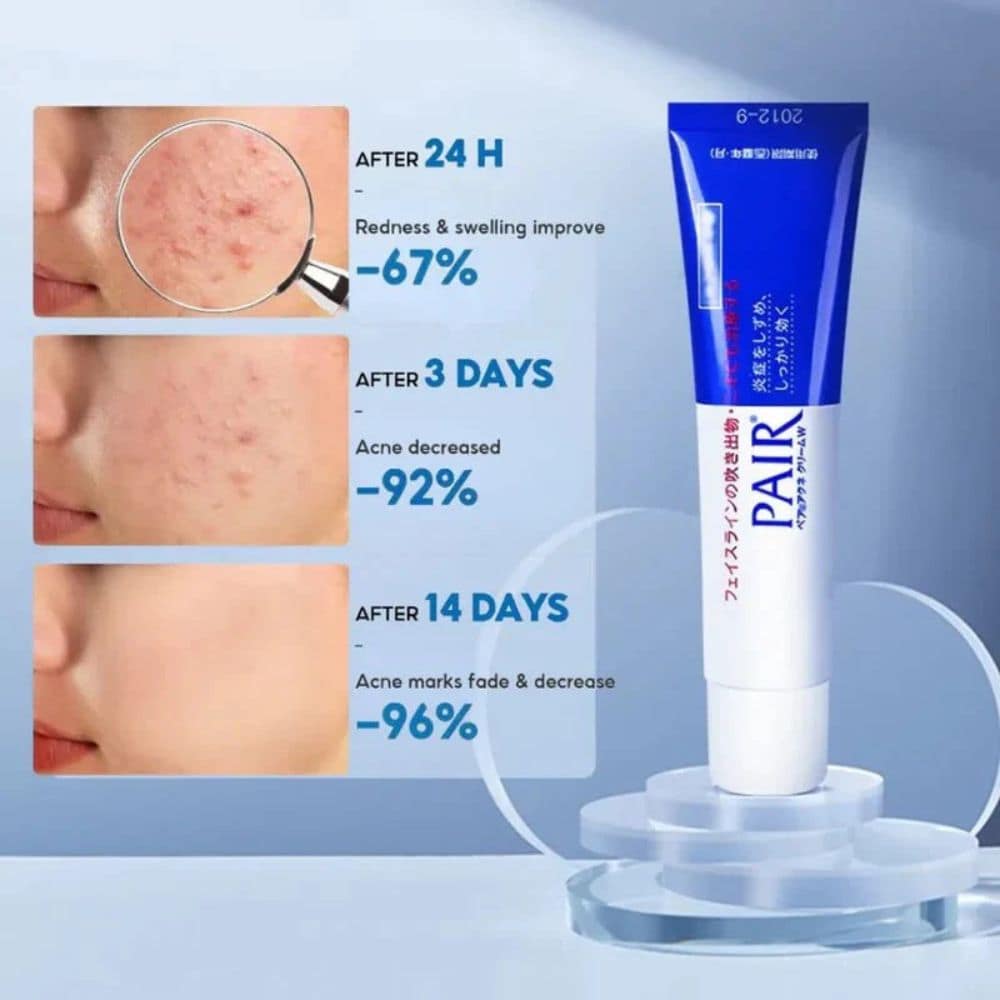 Lion Pair Acne Cream W