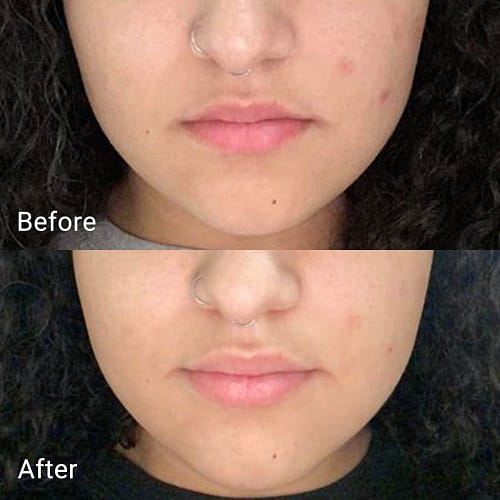 Aprilskin Real Calendula Peel Off Pack