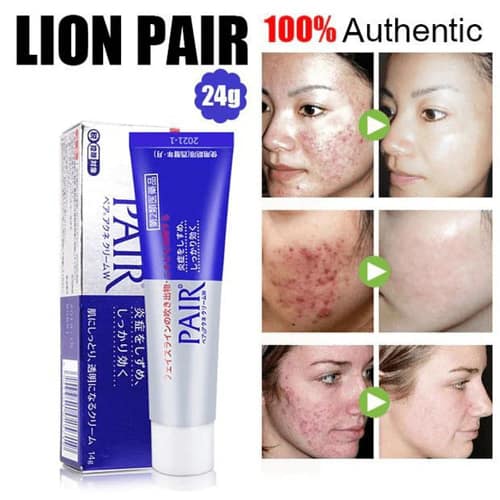 Lion Pair Acne Cream W