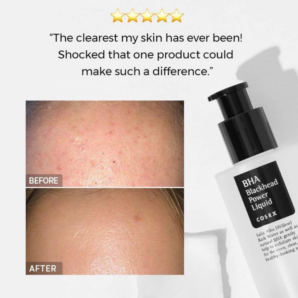 Cosrx BHA Blackhead Power Liquid